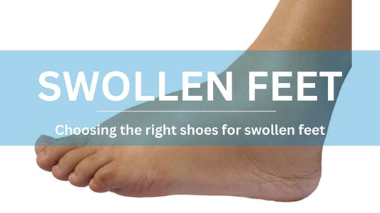 What Shoes to Wear with Swollen Feet